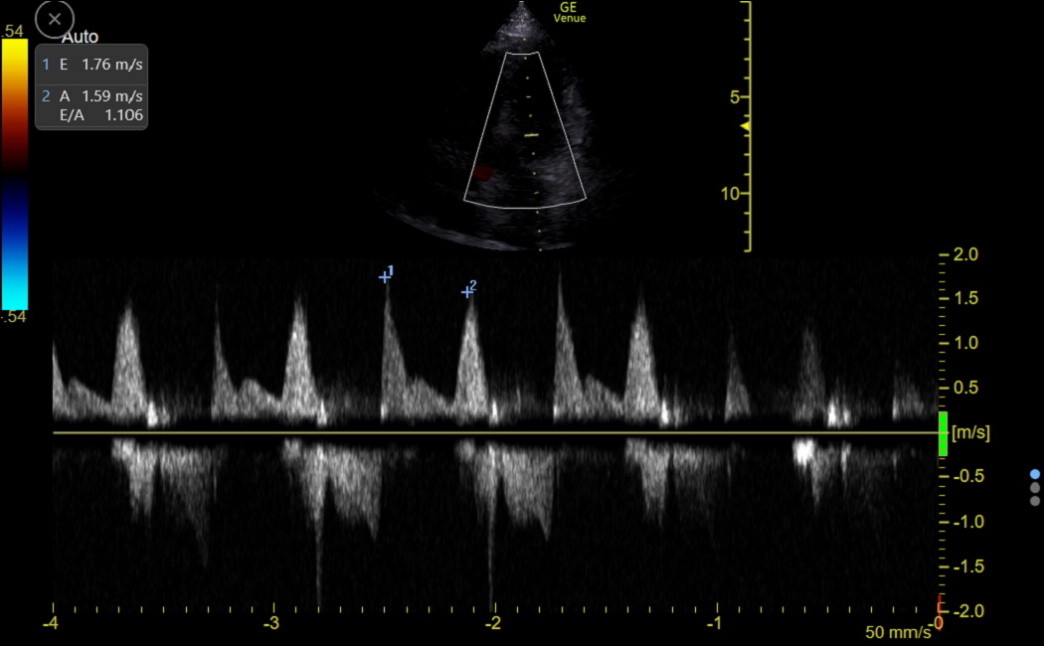 Mastering Diastology: Part 1 Cardioserv